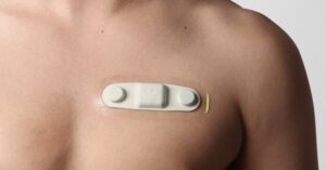 %title插圖%num 貼片健康監(jiān)測(cè)